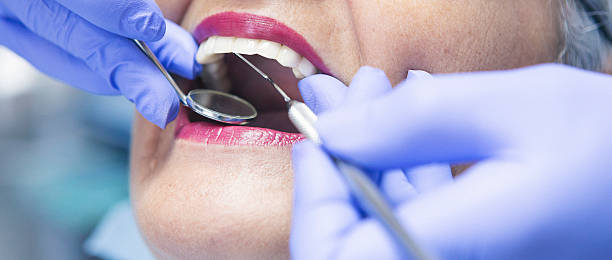 Best Emergency Wisdom Teeth Removal in Concord, CA